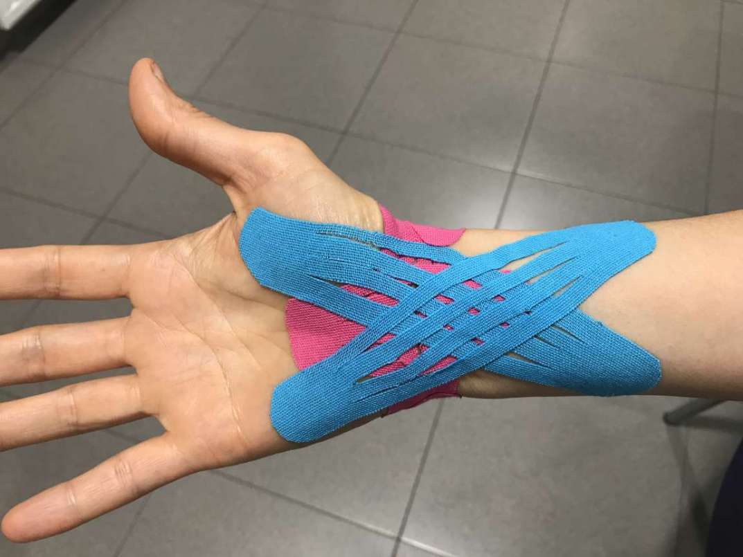 Curso de Vendaje Neuromuscular (Monográfico de hombro y EESS)